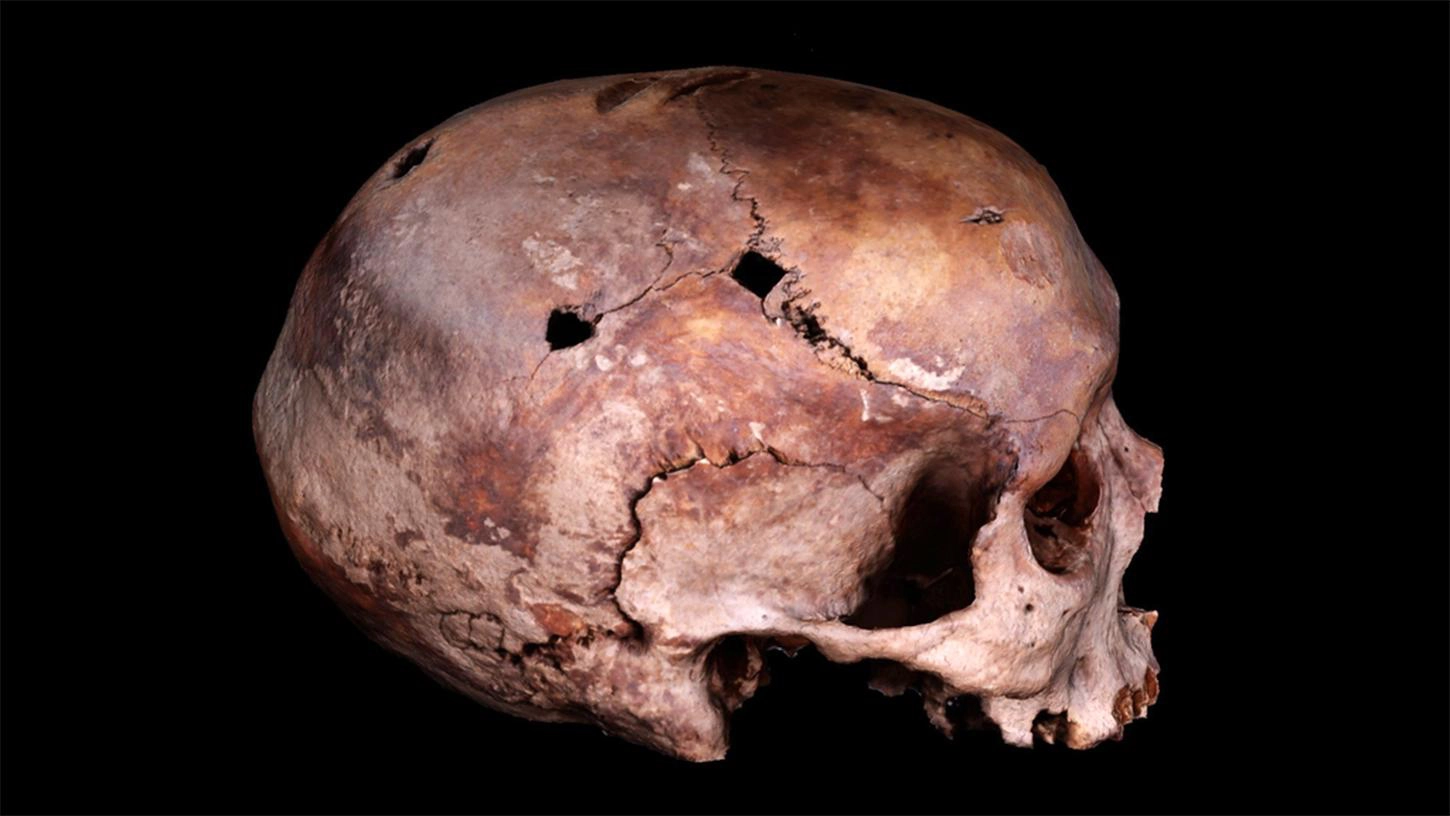 skull from 1361 Battle of Visby